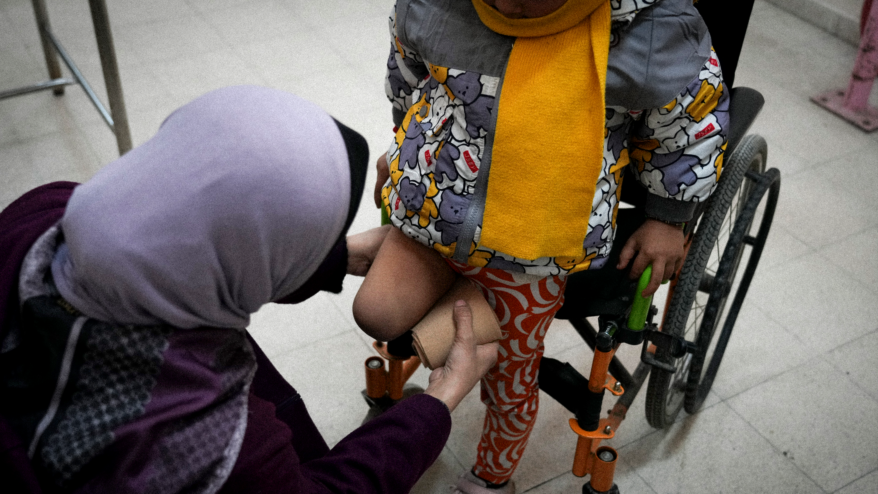 En femårig palestinsk flicka sitter på sin rullstol när en läkare justerar skyddet på hennes högra amputerade ben, Gaza City, februari 2025.