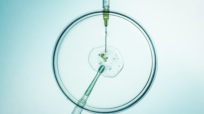 Startupen Orchid Health erbjuder en metod som inte bara sorterar bort ärftliga sjukdomar – utan också hjälper blivande föräldrar att välja ut det optimala embryot. Arkivbild.