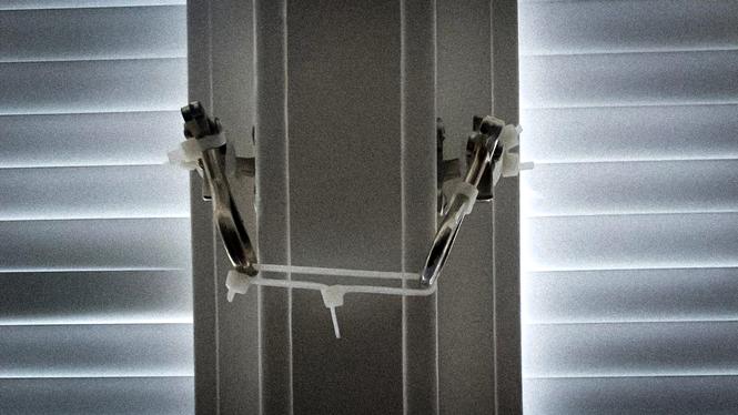 Buntband ska göra fönstren omöjliga att öppna på ett av Marbellaparets familjehem.