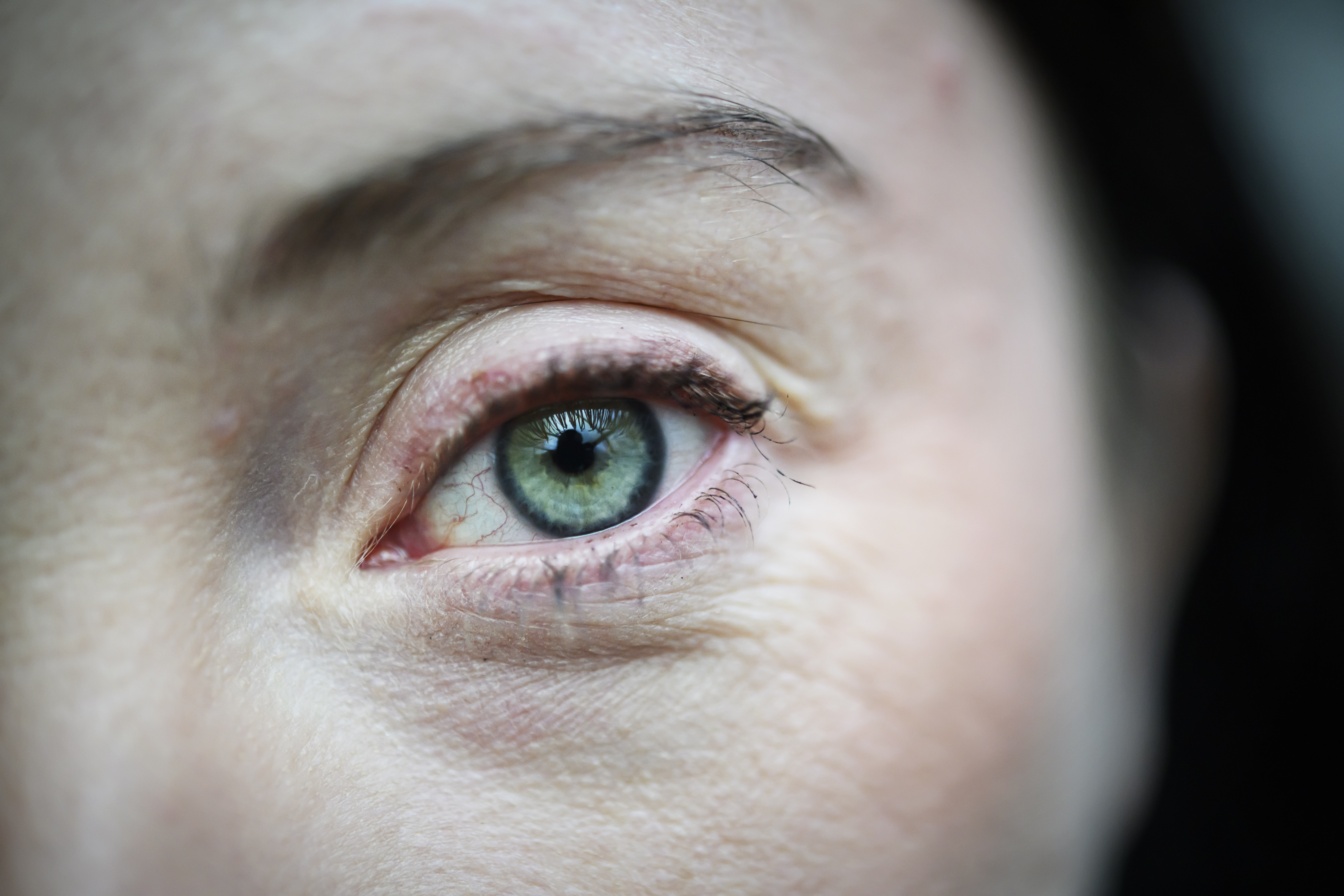 Annas upplevelse är att hon sågs som problemet, att arbetsgivaren tyckte det var lättare att flytta på henne än att ta itu med arbetsmiljön på riktigt. 