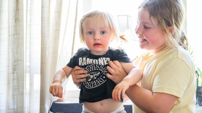 1,5-åriga Emma med nioåriga storasyster Greta bor i Älvdalen.