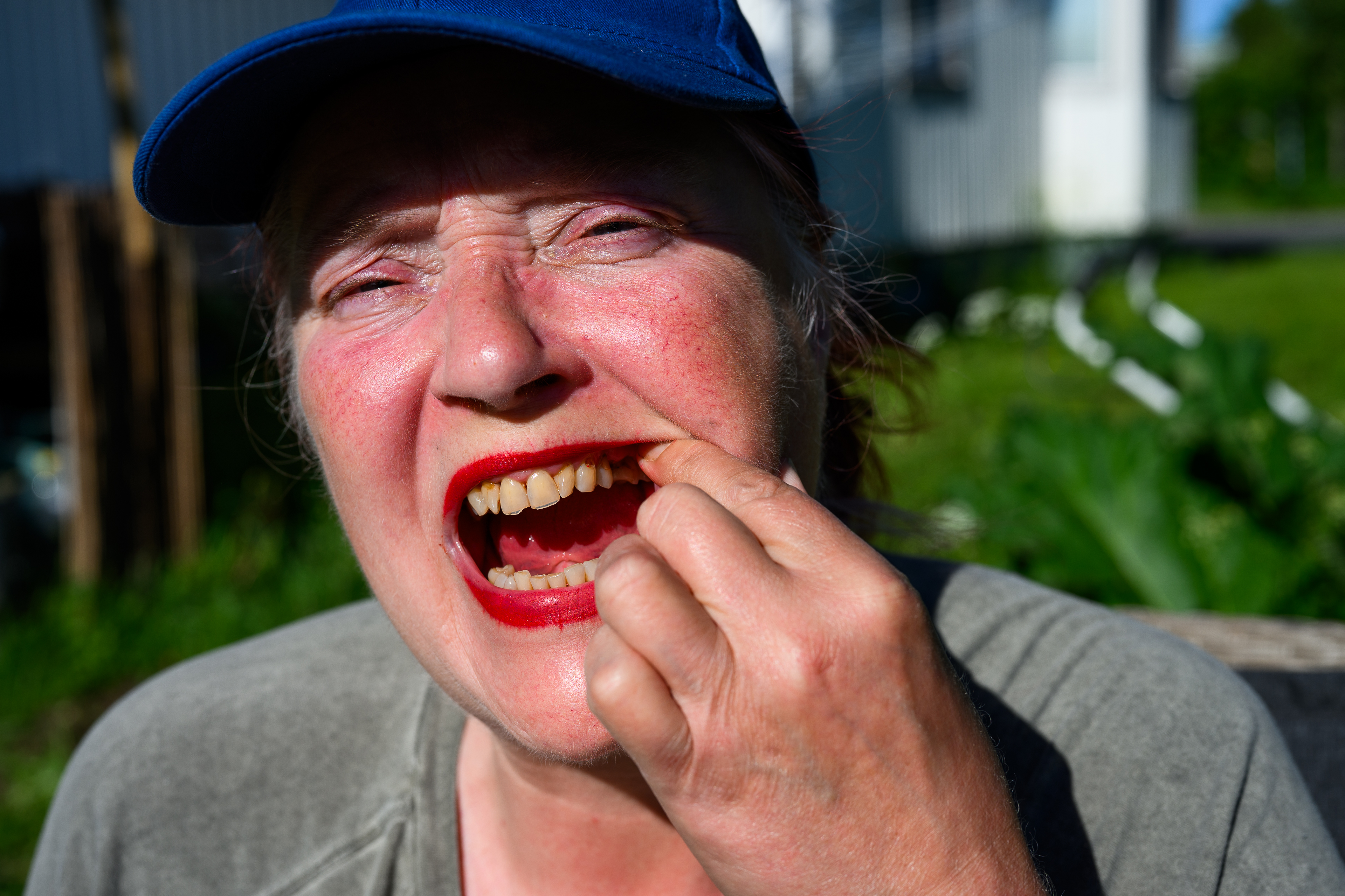 På grund av underbemanning har Folktandvården i Haparanda slutat ta emot vuxna patienter, förutom vid akuta fall.